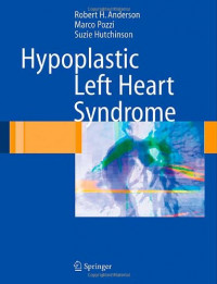 Hypoplastic left heart syndrome